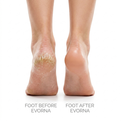 Electric Callus Remover